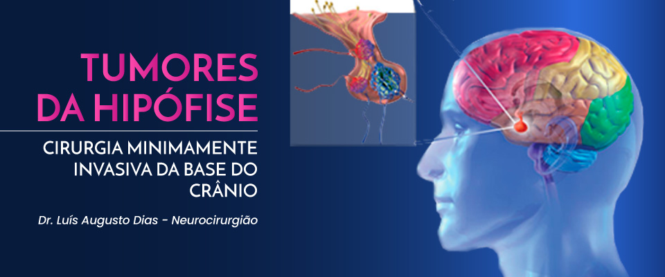 hipófise-dr-luis-augusto-dias